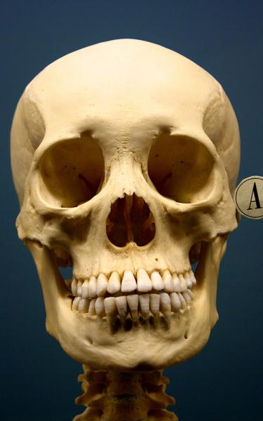 A photo of a human skull. 