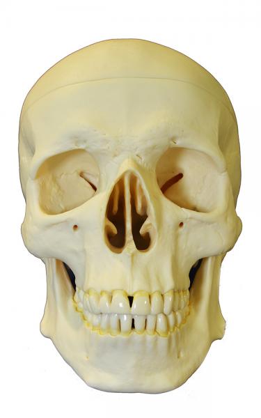 A photo of a human skull. 