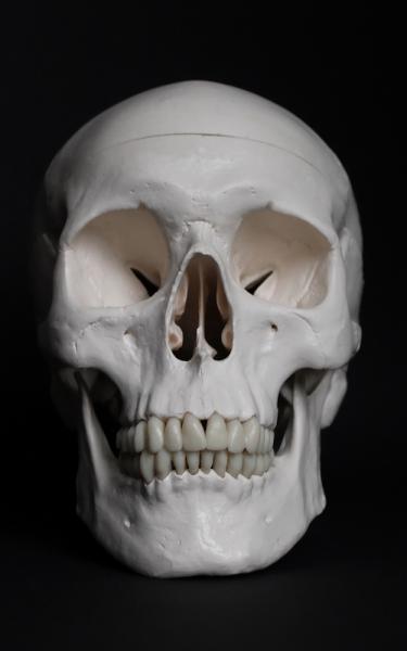 A photo of a human skull. 